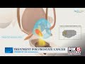 Treatment for prostate cancer