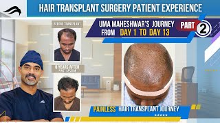 Hair Transplant In Bangalore | Best Surgeon Clinic & Cost Of Hair Transplant In Bangalore