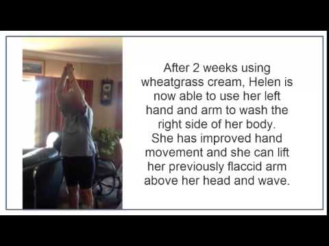 Dr Wheatgrass Stroke Recovery Testimonial. Case #4. Left hemiplegia Dr Wheatgrass Stroke Recovery Testimonial. Case #4. Left hemiplegia