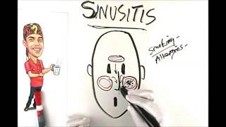 Sinusitis Explained Simply