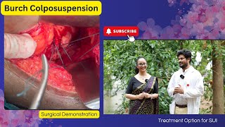 Burch Colposuspension | Treatment option for SUI | Cost Effective