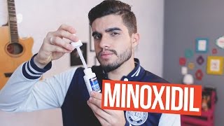 DICAS PARA USAR O MINOXIDIL