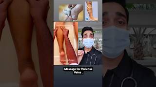 Massage for Varicose Vein.