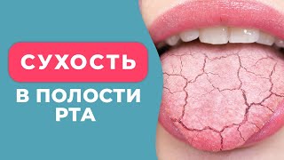 Почему появляется СУХОСТЬ ВО РТУ и как с этим бороться? / КСЕРОСТОМИЯ полости рта