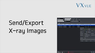 VXvue Quick Guide 05. Send and Export X-ray Image