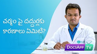 చర్మం పై దద్దుర్లకు కారణాలు ఏమిటి? #AsktheDoctor