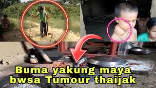 Buma yakung Manya bwsa Tumour thaijak jwngjalo kwlaijak nukhung chubachu sankha