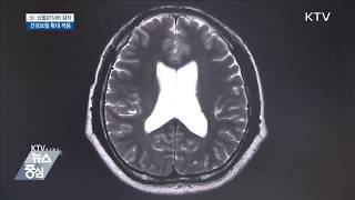 뇌·뇌혈관 MRI 검사 본인 부담 대폭 인하