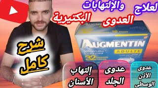 Augmentin  مضاد حيوي واسع المجال لعلاج العدوى والإلتهابات البكتيريا للجهاز التنفسي العلوي والسفلي