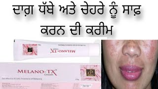 Treatment of melasma in Punjabi language (ਦਾਗ਼ ਧੱਬੇ ਅਤੇ ਚੇਹਰੇ ਨੂੰ ਸਾਫ਼ ਕਰਨ ਦੀ ਕਰੀਮ)