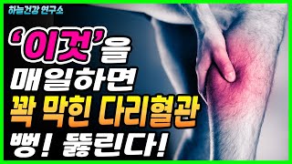 이것을 매일 했더니 꽉 막혀있던 다리혈관 뻥! 뚫렸다! 혈액순환 잘되는법