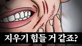 입술 옆에 딱 붙은 흉터 깔끔하게 지우는 방법