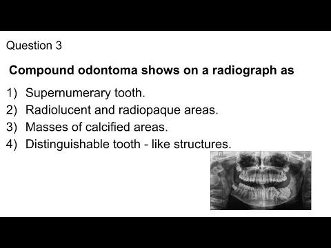 Inbde Sample Questions Oral Pathology Youtube