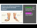 colles fracture distal radius fracture x ray reduction symptoms causes signs colles vs smith s