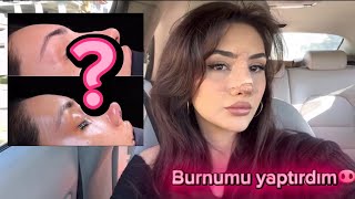 TÜRKÇE ASMR / BURUN AMELİYATI OLDUM 🥲👃 / FISILTI / AMELİYAT SÜRECİ VLOG🫧