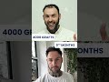 hair transplant result after 9 months