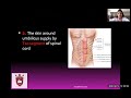 dr. swapnil soni anatomy of the umbilicus