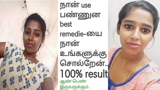 நான் use பண்ணுன home remedies  ல best Remedie இது தான் /Tamilbeautytips /skin Whitening mask