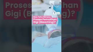 Proses Pemutihan Gigi | Bleaching Treatment