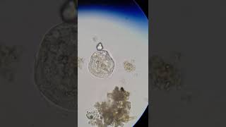 Freshwater ciliate