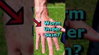 Worm Under Skin? Gigachad Vein Check |  Veiny Hands | Veins Popping Out #shorts