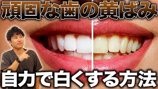 【歯を白くする方法】自力で歯の黄ばみを落とす方法を医師が解説！