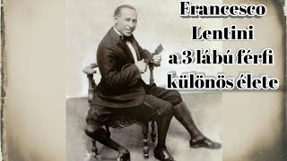 Francesco Lentini a 3 lábú férfi különös élete | Szokatlan és el nem felejtett S01E04