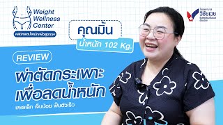 #รีวิว ผ่าตัดกระเพาะ เพื่อลดน้ำหนัก | คลินิกลดน้ำหนักเพื่อสุขภาพ #ผ่าตัดกระเพาะลดน้ำหนัก