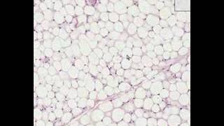 Shotgun Histology Adipose Tissue