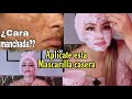 Cómo eliminar  manchas oscuras , melasma, cloasma, manchas negras de la Cara  por el sol