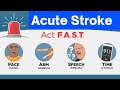 Case Discussion || Acute Stroke