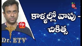 Leg Swelling - Cause and Treatment | కాళ్ళల్లో వాపు - చికిత్స | Dr.ETV | 5th August 2021 | ETV Life