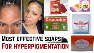 *Affordable* And Most Effective Hyperpigmentation Soap