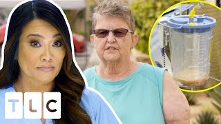 Dr. Lee Uses Liposuction To Remove Growths On A Woman’s Arms | Dr Pimple Popper