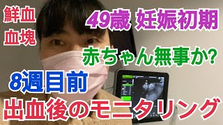 【49歳 妊娠初期】鮮血・血塊出たけど赤ちゃん大丈夫？8週目前のモニタリング