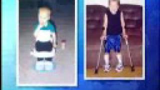 Devons story - Dayton Childrens Medical Center