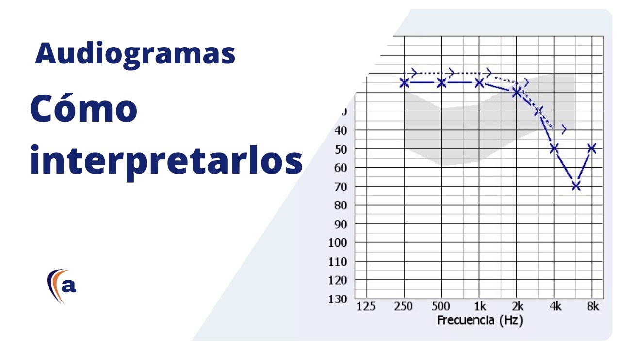 AUDIOGRAMA | Entiende El Resultado De Una Audiometría Tonal - YouTube