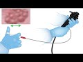 Endoscopy Technology Theory-Lesson 11-Handling Accessories