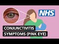 Conjunctivitis: symptoms and treatment for red, itchy, watery eyes | NHS