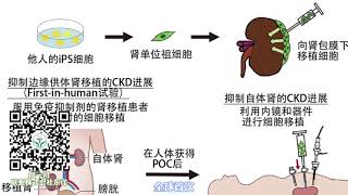 日本利用iPS细胞挑战肾脏再生，减少人工透析患者！日本开发了移植可以保护肾脏的肾祖细胞的细胞疗法，并计划推进实用化，这一医学成果将改变世界。