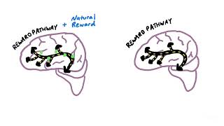 How an Addicted Brain Works