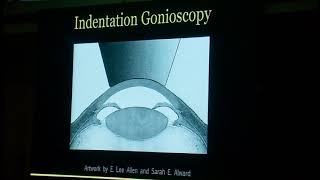 Gonioscopic techniques for difficult angles