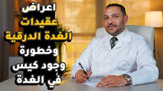 اعراض عقيدات الغدة الدرقية وخطورة وجود كيس في الغدة