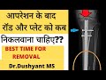 आपरेशन के बाद रॉड और प्लेट को कब निकलवाना चाहिए ?? | Best Time For Removal |  Dr.Dushyant MS Ortho |