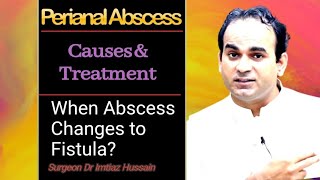 Perianal Abscess | Causes & Treatment | Surgeon Dr Imtiaz Hussain