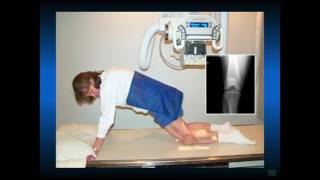 629 PT3 - Knee - Imaging What Plain Views and When