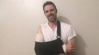 Biceps rupture Day 3 after surgery my second arm distal tendon tear see animation of surgery @ 6:05