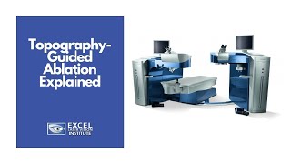 Topography-Guided Ablation Explained