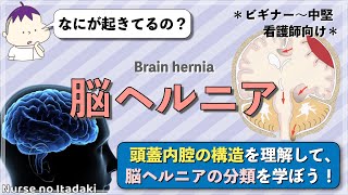 【脳ヘルニアとは？】頭蓋内腔の構造を理解し､脳ヘルニアの分類を学ぼう！