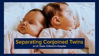 Separating Conjoined Twins at UC Davis Children's Hospital